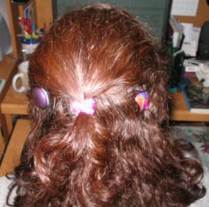 Wendi's cochlear implants from the back